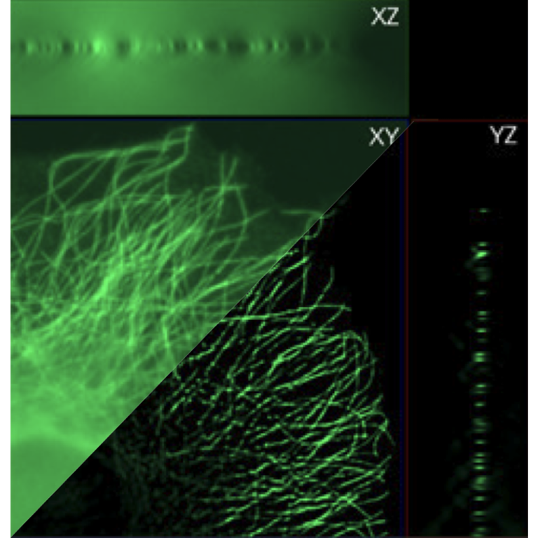 Comparaison de projections orthogonales avant et après déconvolution