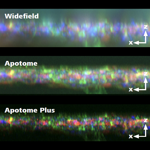 ZEISS Apotome Plus